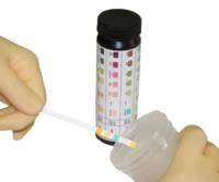 Image of Urinalysis Test Strips and Tablets
